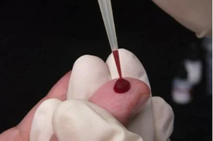 Analisi del sangue per elminti