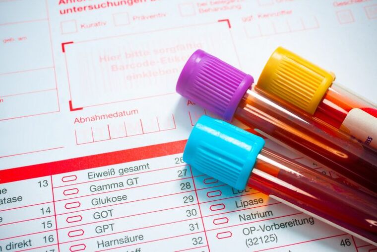 Sangue per la ricerca sui parassiti